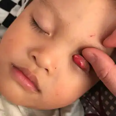 哪位宝妈知道的,帮我看看.快一个月了去大医院两次