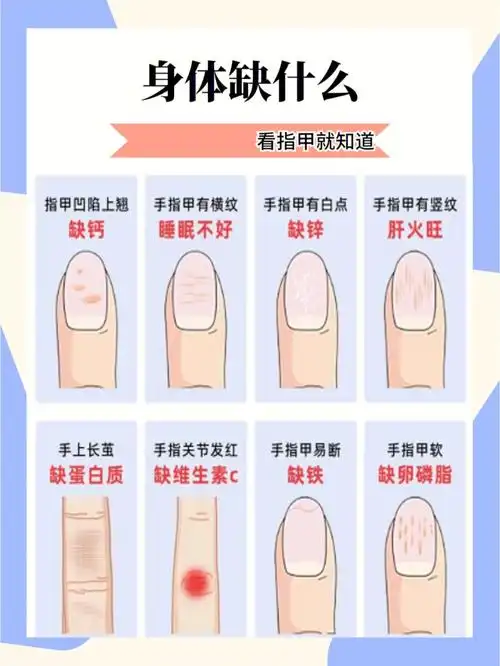 指甲颜色看出身体缺少什么女孩子必看75
