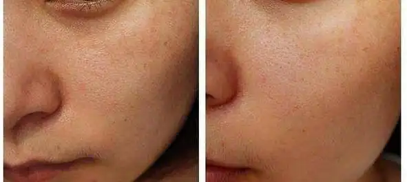 我的21天"换脸之路"!见证皮肤从暗沉到透亮,开心不止一点