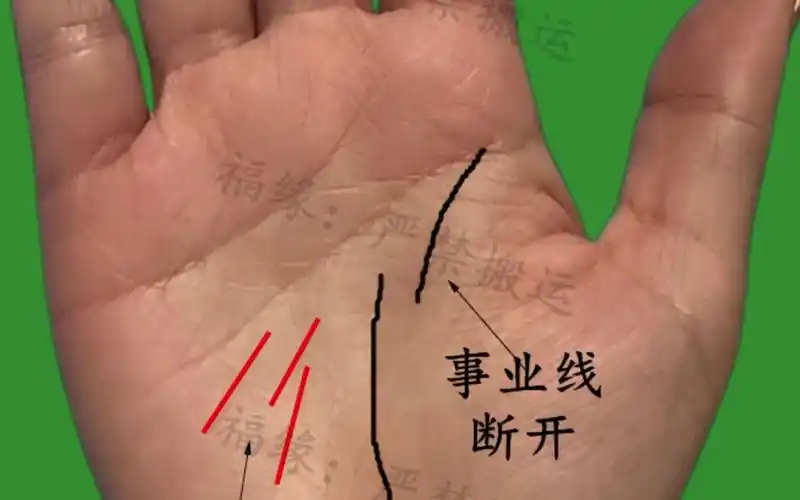 生命线断开怎么看?