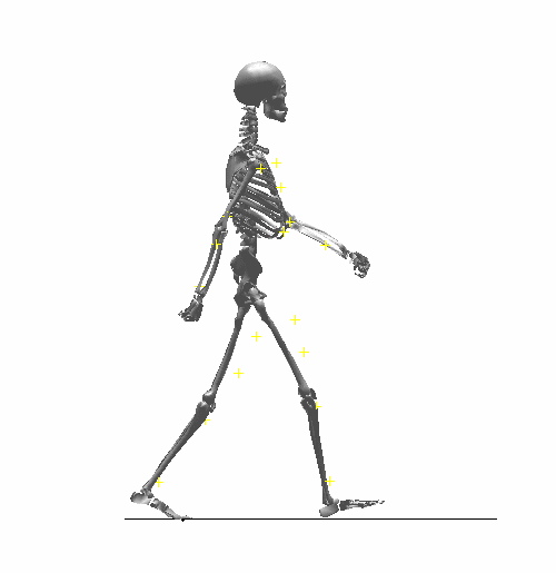 卒中后步行那点事! - 美篇