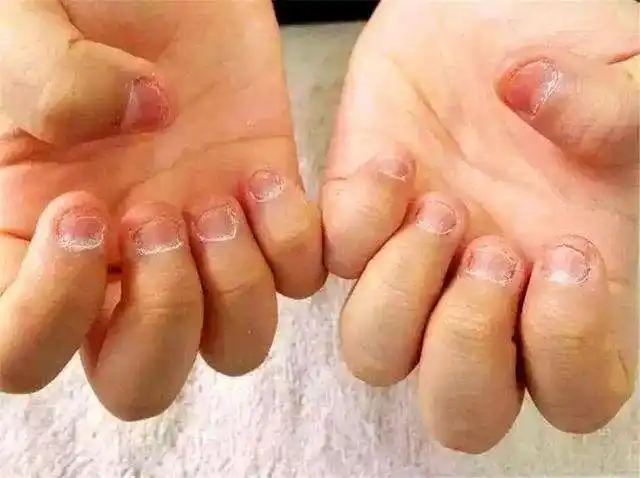 小朋友爱咬手指头是什么原因? - 知乎