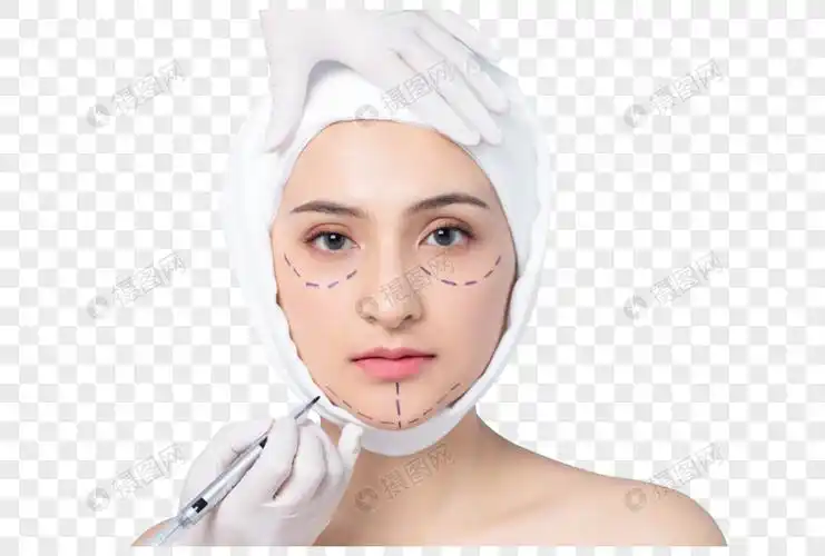女性面部整形术前画线