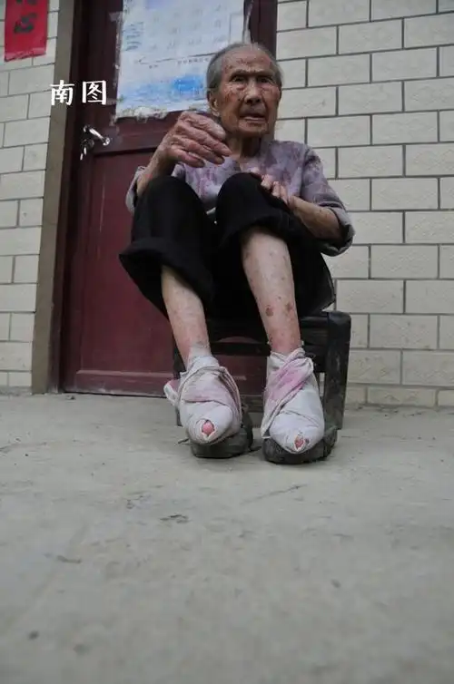 住着三名保留着三寸金莲小脚的老人,她们虽然年过耄耋之年,身体依然很