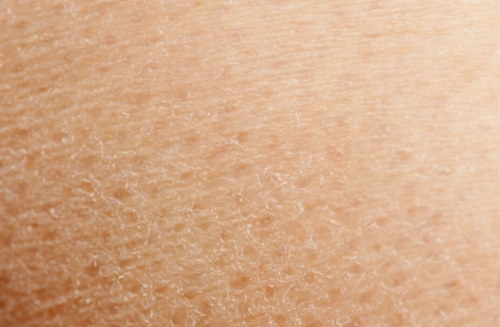 秋冬皮肤容易干燥,起皮,不用怕!学会这4招,肌肤水嫩细腻