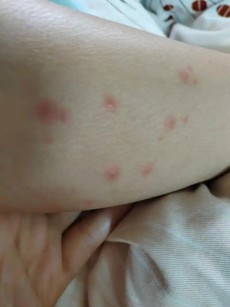最后抵抗力下降皮肤过敏!这次孩子生病让我 - 抖音