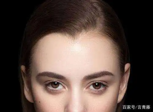 如何判断自己的发际线是否完美