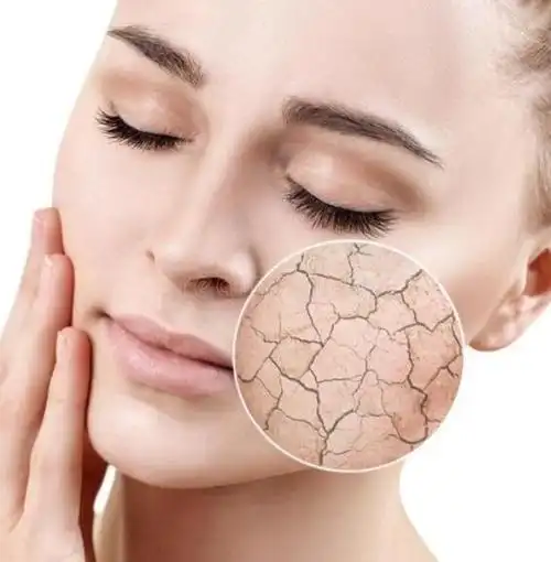 夏天,长期坐在空调房的白领会感觉皮肤干燥.