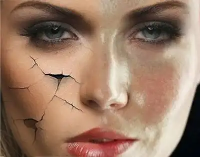 脸上皮肤粗糙怎么办,如何拥有美肌