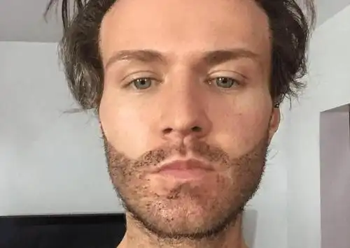 男子因胡子稀疏不自信,花9000英镑移植,最后都称帅呆了