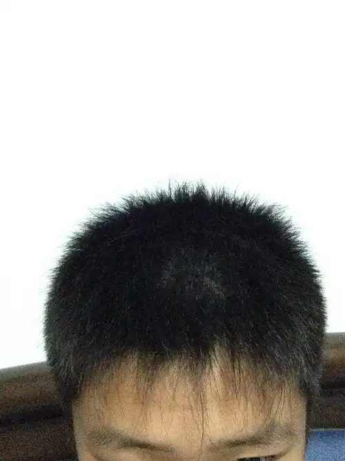 前额头发被打薄了 现在想留刘海 要怎么剪 怎么和理发师说