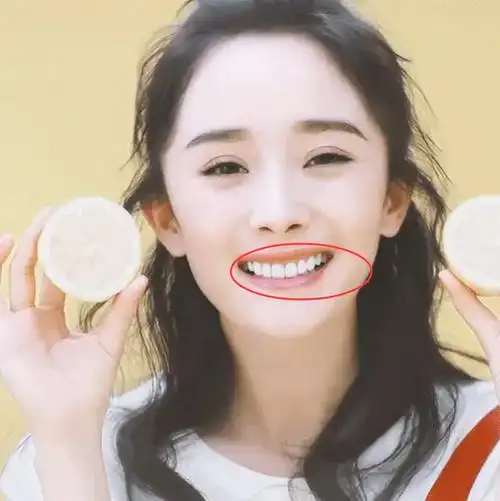 杨幂热巴烤瓷牙都翻车,赵丽颖宋茜天然牙很可爱,明星真不该动牙|虎牙