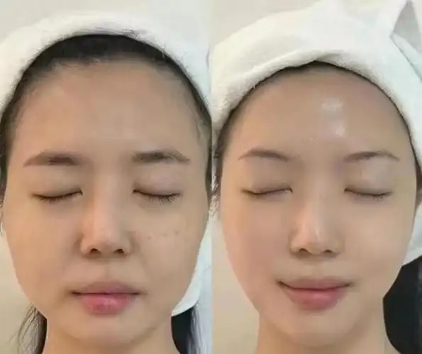 什么牌子的护肤品抗皱紧致比较好?这套效果真的超好!