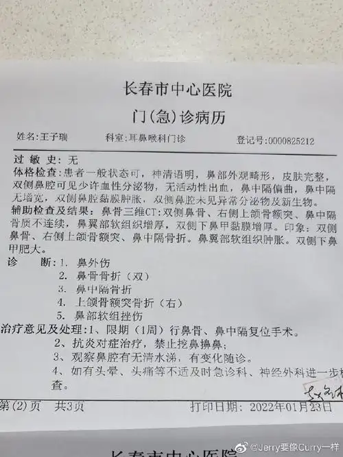 王子瑞鼻骨骨折将进行手术同曦轮换雪上加霜