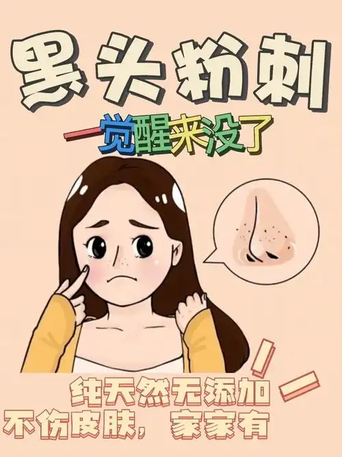 黑头粉刺|一觉醒来没|不伤皮肤|纯天然