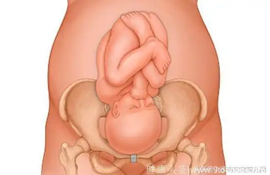孕晚期,胎宝宝入盆是一种怎样的体验?5种感觉说明你就要生了!