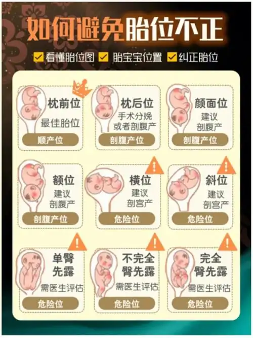 胎位不正怎么办及时纠正助力顺产