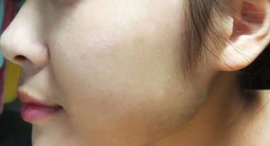 换季时皮肤干燥起皮?新手妈妈需要关注室内湿度