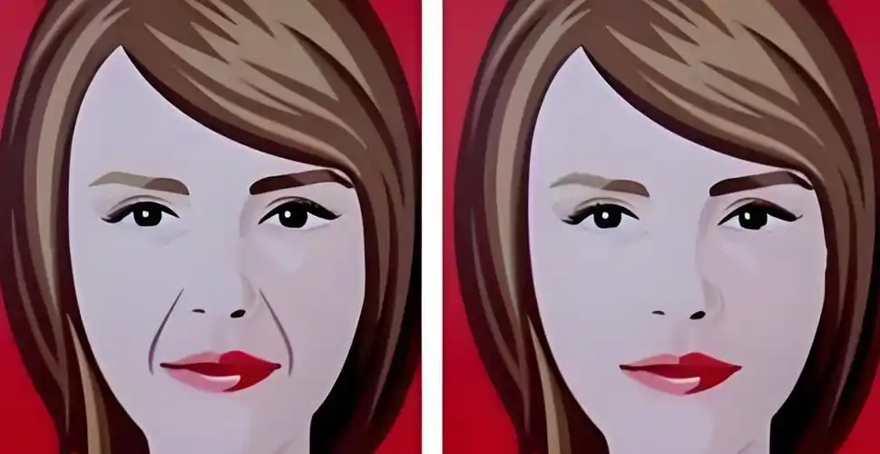 面部脂肪填充,是我在医美领域不断探索的重要部分