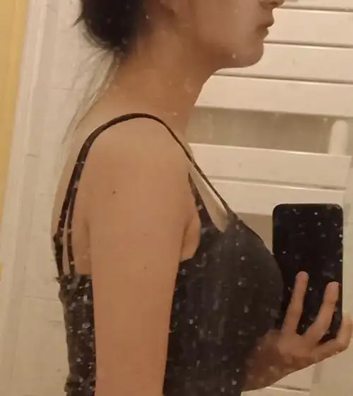 请问刘亦菲们脖子前倾怎么改善呀