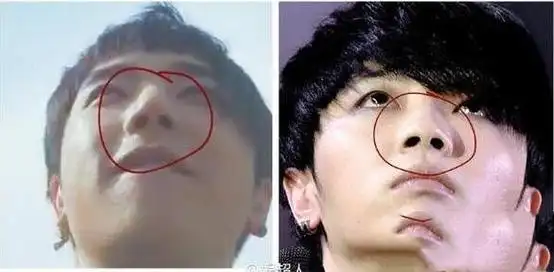 华晨宇整容前后照片对比