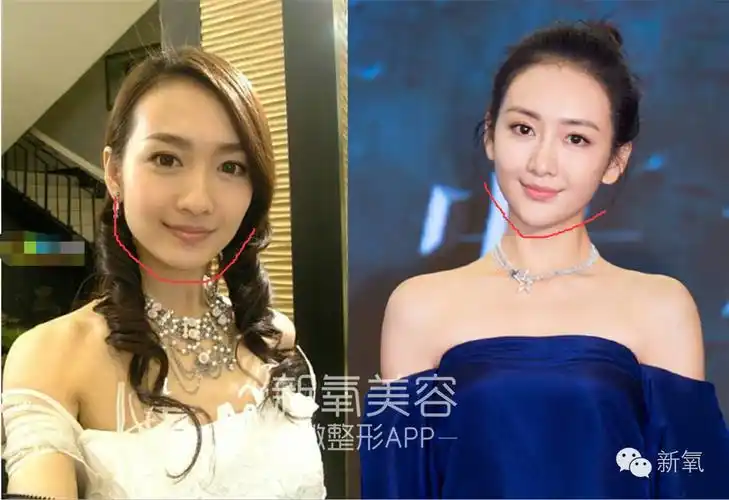 刘恺威出轨王鸥?好像两人还整出了夫妻脸