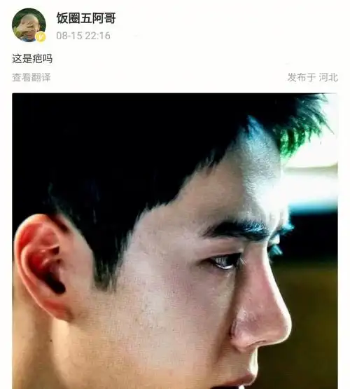 王一博么,怎么忽然鼻子上有了那么一个大疤痕啊,随手找了几张他侧脸