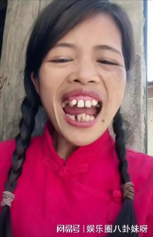 凭借奇葩长相走红网络他们一丑成名但却一个比一个有钱