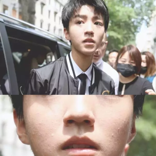 只能怪化妆师不用心,因为痘痘完全是可以遮掉的,而且王俊凯面对的是