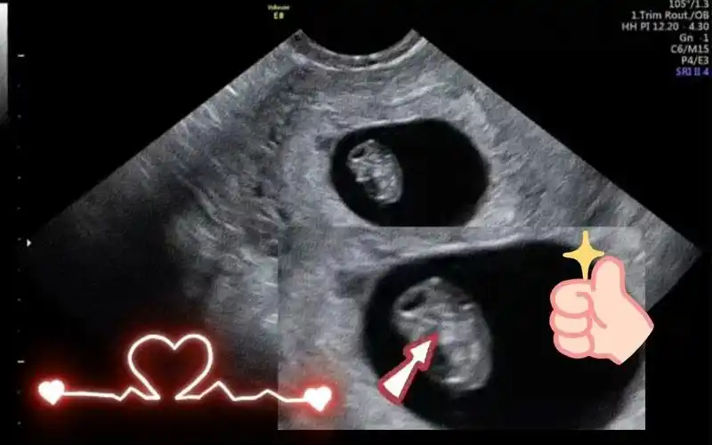 怀孕50天,胎宝宝胎心胎芽都有了