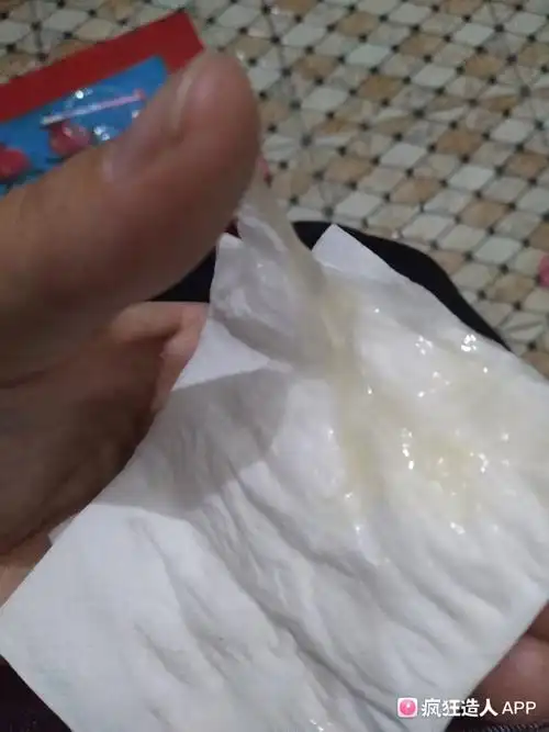[试管婴儿]这样是白带拉丝吗?有图慎点