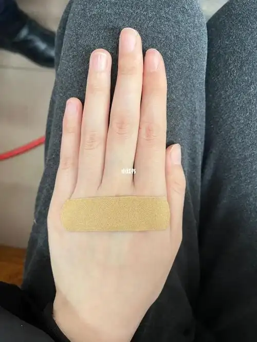 手上划拉了一条口子,这地方也不好贴创可贴啊01