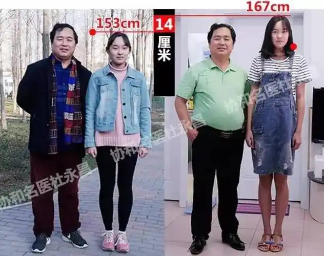 的家长会选择盲目等待或相信"孩子晚长";87%的家长没有监测孩子的身高