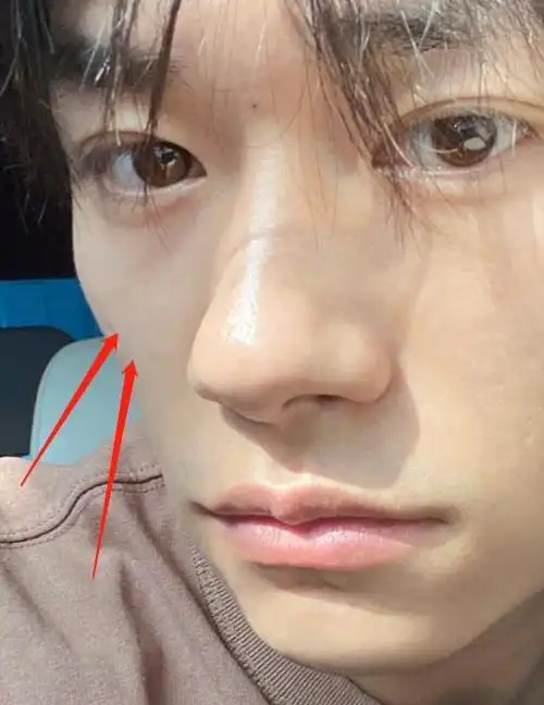 易烊千玺久违地更新近况,素颜怼脸照好真实,最大的变化在这里