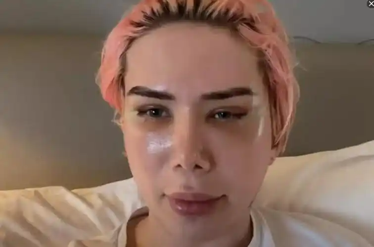 英国男子花费近百万整成偶像8年整容18次自称自己是韩国人