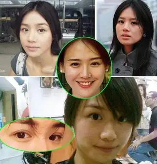 马思纯承认割双眼皮