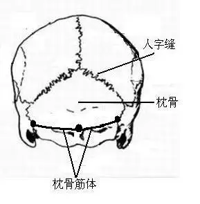 右脑后枕骨在哪里?