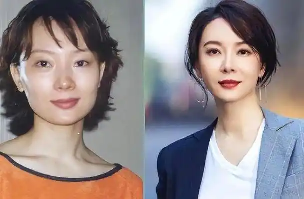 从大饼脸变小v脸却不承认整容醒醒吧真颜早被基因出卖