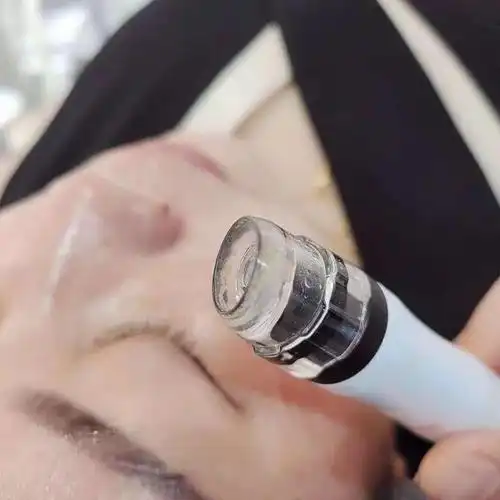 小气泡深层清洁可能会让少部分皮肤脆弱的求美者造成皮肤过敏现象