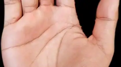 手相案例分析,凤眼纹