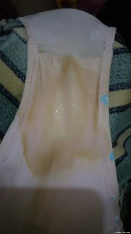 怀孕十五周内裤湿湿的不会是流羊水吧