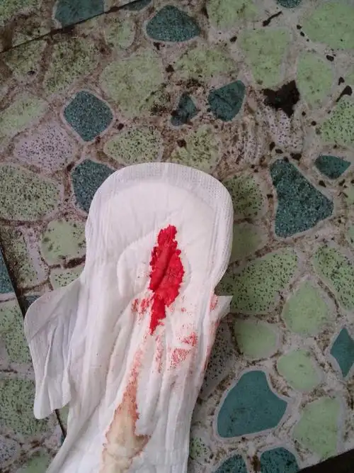 今天来月经了,这两个月坚持泡脚热敷,还是有点效果的,心情也好点了.