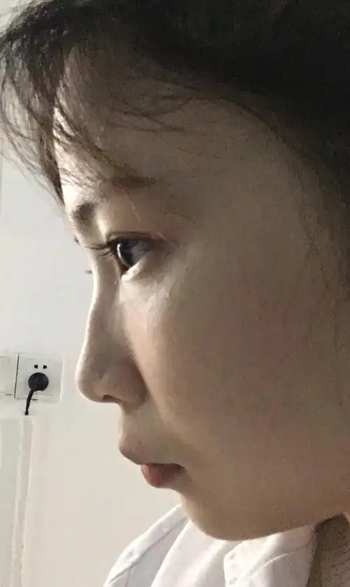 第一次觉得自己凸嘴,好难看的侧脸