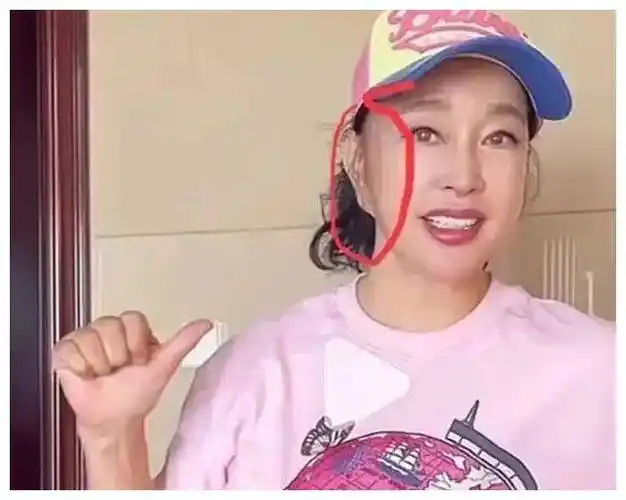 刘晓庆经常进行拉皮手术,导致她的耳朵变得扭曲,给人一种非常奇异的