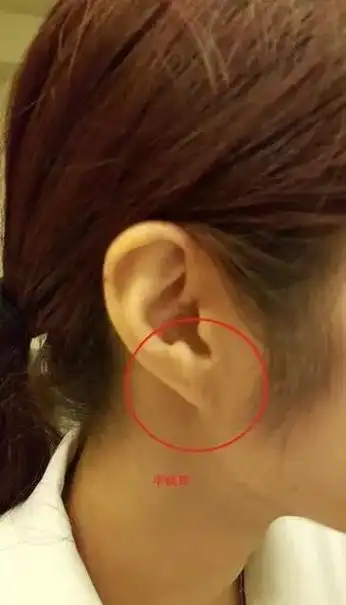 面相耳朵的位置看命运耳朵的颜色以白色为佳,这样的人非常聪明,做事