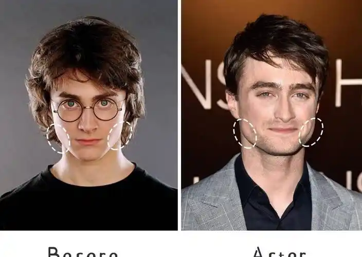 中年少女的"发腮"比发福更可怕_cr_发型_类型