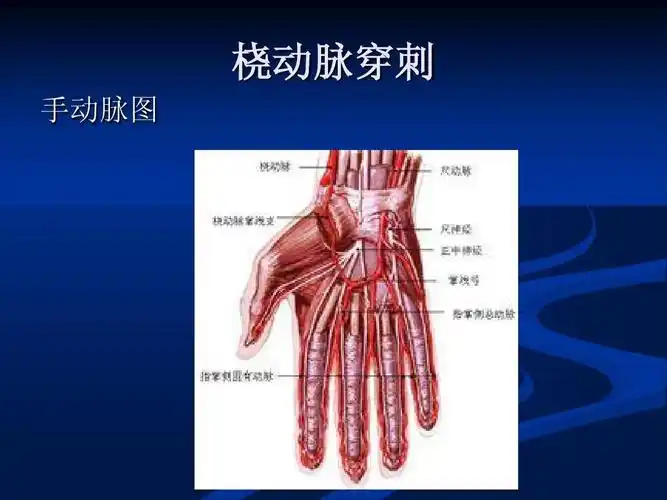 下肢动脉硬化闭塞症介入治疗并发症ppt