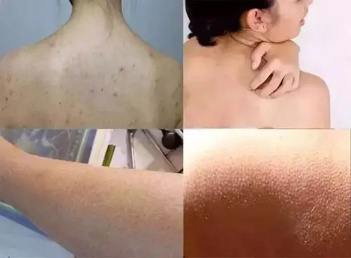 干燥粗糙鸡皮肤?法国女人都在用的身体乳,涂完秒穿丝袜,嫩到想睡了自