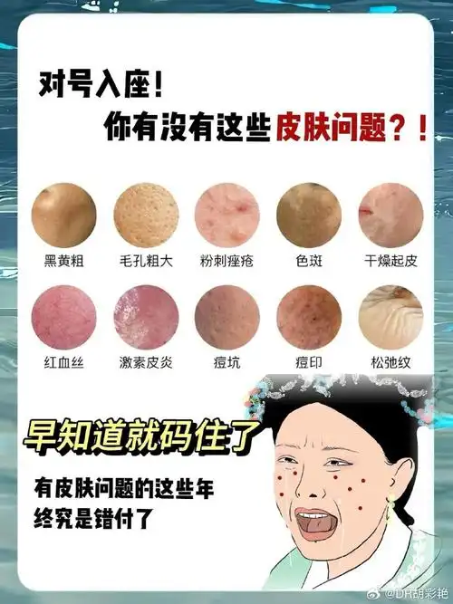 #护肤##黄金微针##痘痘##痤疮##皮肤美容##保养##疤痕