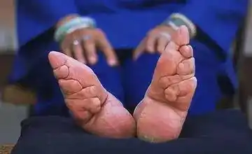 裹脚是从什么时候开始的五六岁就要裹脚